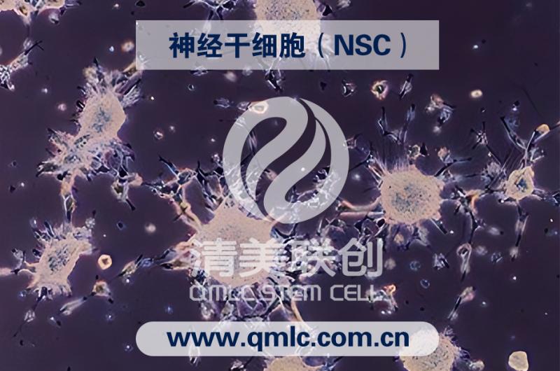 67種干細胞代工加盟 神經干細胞（NSC）清美聯創